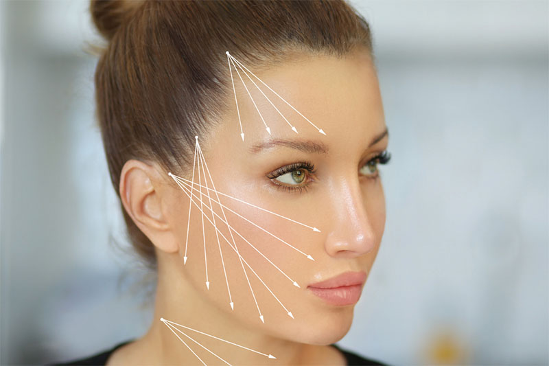 What Is Facial Thread Lift? – Lydian Clinic