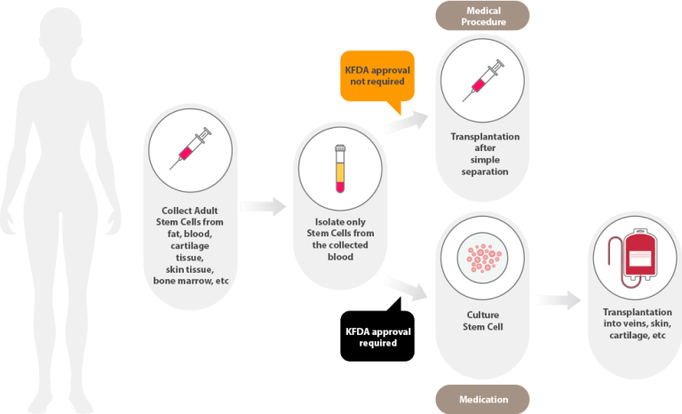 Stem Cell Therapy in Korea at Lydian Clinic (in Gangnam