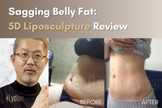 Sagging Belly Fat: 5D Liposculpture Review at Lydian Clinic — Moms & Busy Professionals