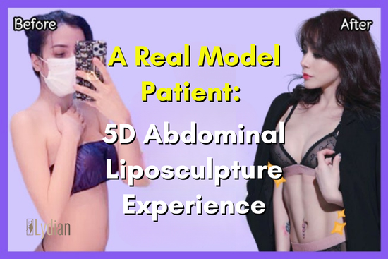 A Real Model Patient, Her 5D Abdominal Liposculpture Experience in Seoul: Natural 11-Line Abs at Lydian
